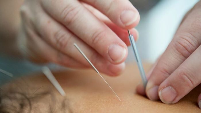 Close-up of hands inserting thin acupuncture needles into a person's skin on a treatment table